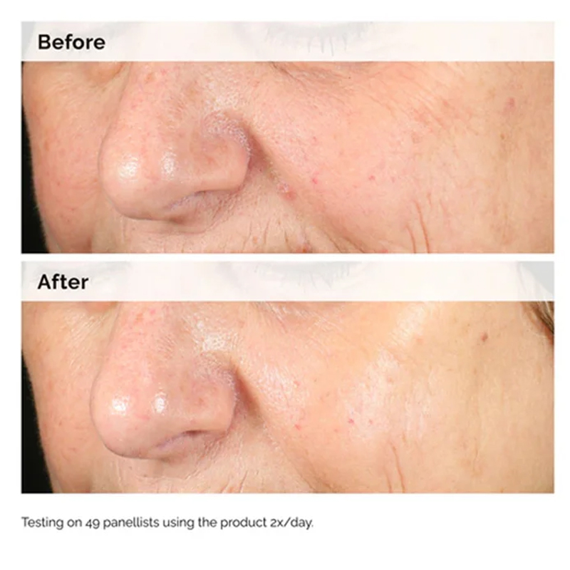 Alpha Arbutina 2% + HA 30ml Su - Alpha Arbutin Serum reseña y precio