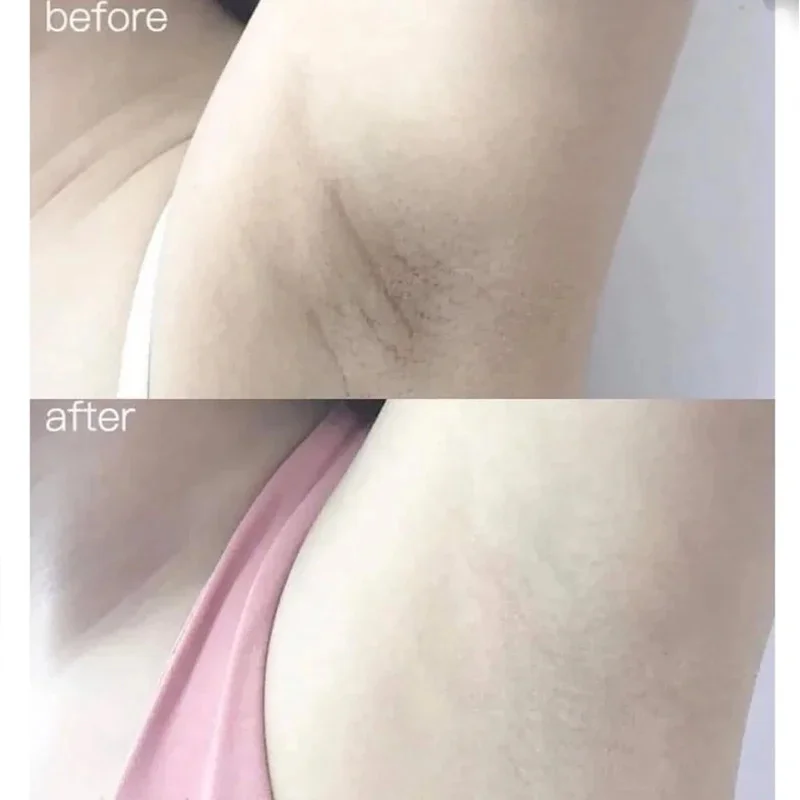Suero corporal blanqueador de  - Alpha Arbutin Serum reseña y precio