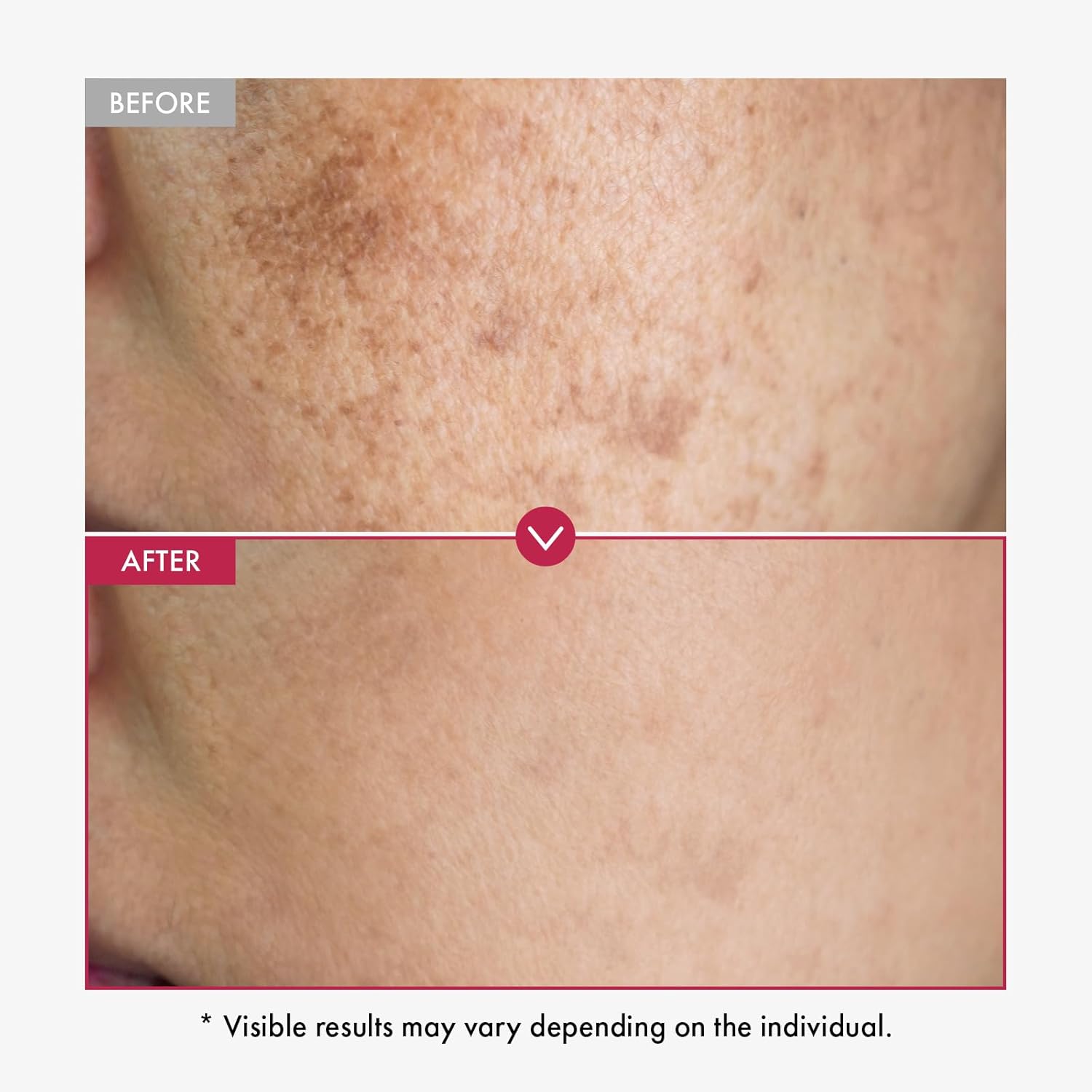 Suero de alfa arbutina AHA man - Alpha Arbutin Serum reseña y precio