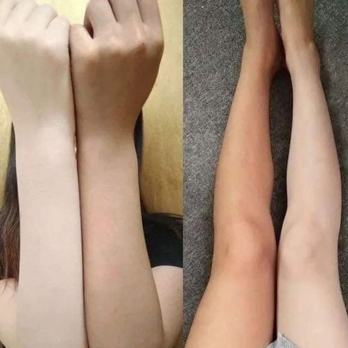 ng Suero kaki trng da Alpha Ar - Alpha Arbutin Serum reseña y precio
