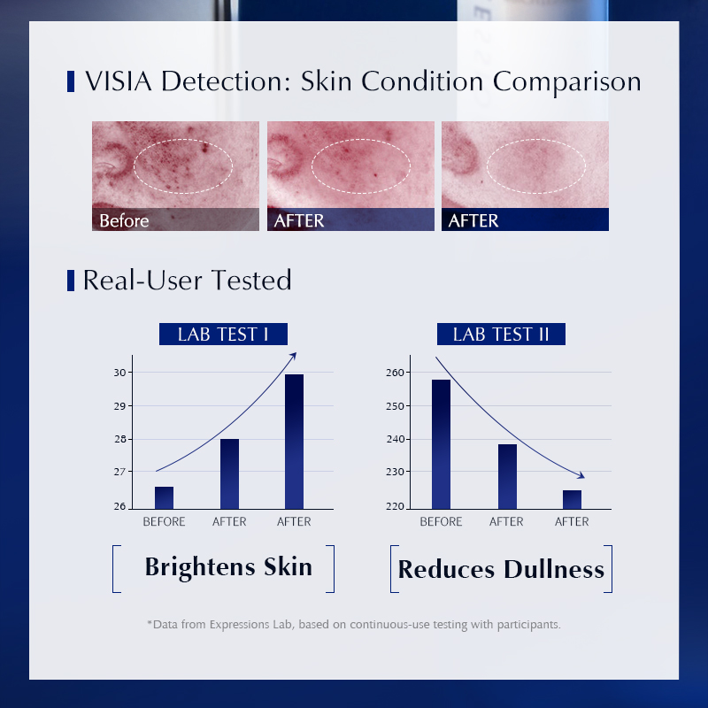 Suero Aclarante para Manchas O - Alpha Arbutin Serum reseña y precio